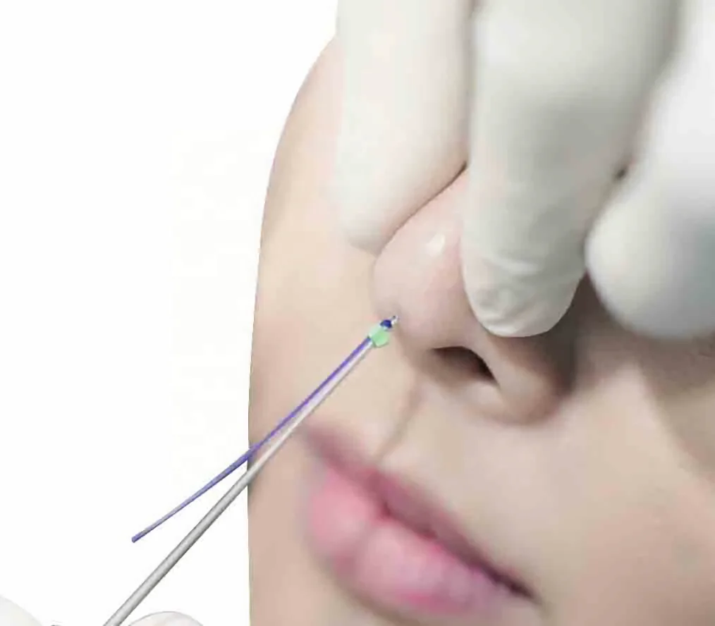 Premium Mono Collagen Thread Face Lifting Korean Hilos Tensores Para Cara Y Cuello