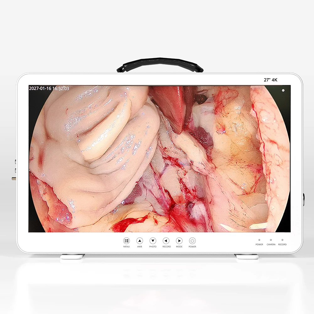 All In One 27 Inch 4k Hd 1080p Ent Portable Endoscopic Video Camera Integrated With Led Light Source