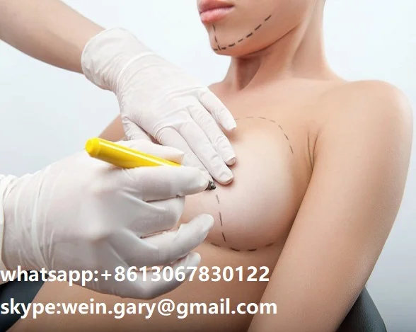 
100% Cross-linked injection acid injection acid hyaluronic acid 50ml ultra deep 