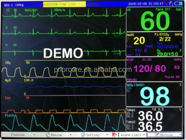Medical Equipment Suppliers 12.1 Inch CA600 Multi Parameters Vet Patient with EtCO2 Module