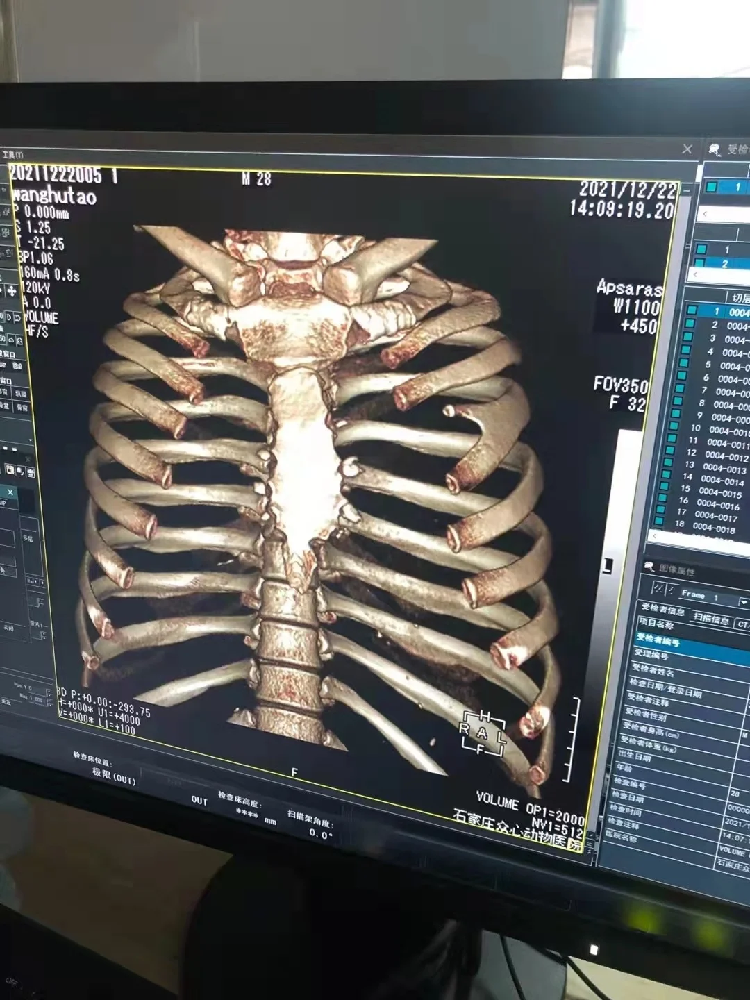 Ветеринарный CT-экран поставка системы CTscreener DR xray визуализация животных ветеринарный CT-сканер ультразвуковое снабжение