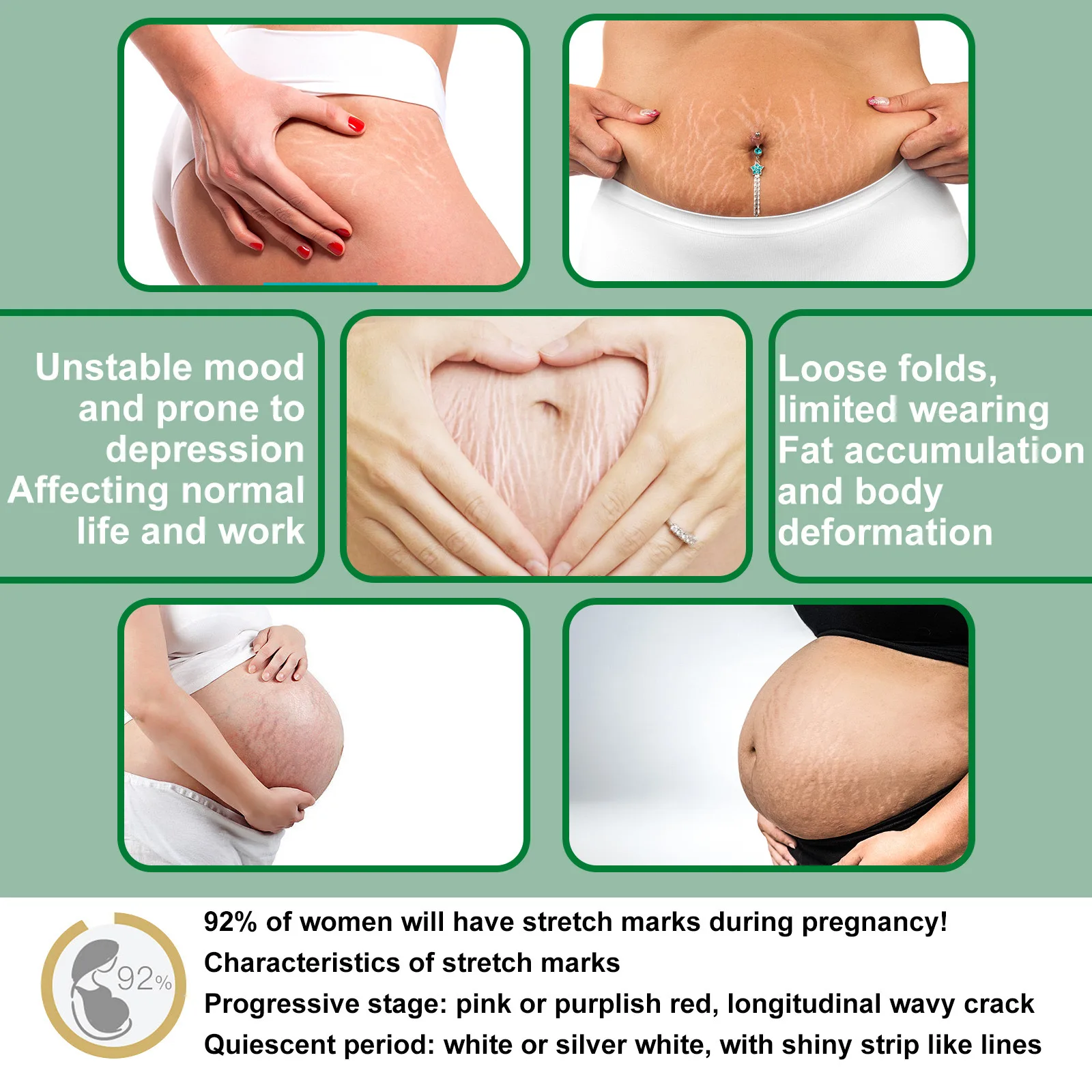 Hot Sale 100% Safe Natural Vegan Anti Postpartum Vergeture Marks Removal Repairing Scar Stretch Mark Spray