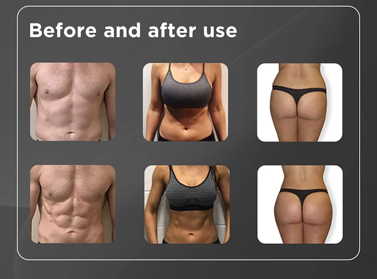 ADSS Big Powerful Four Handles EMS Muscle Stimulation Body Contouring Muscle Sculpting Machine