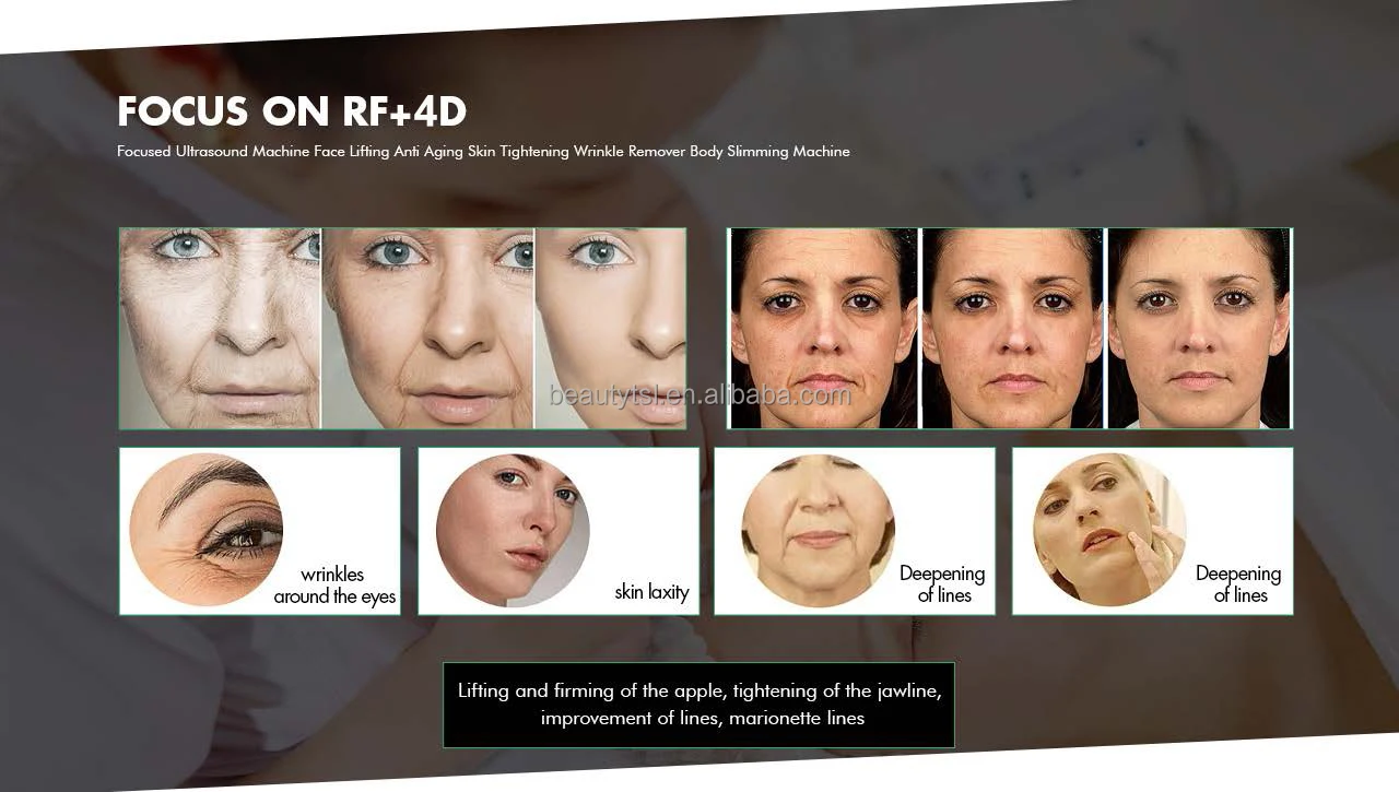 FU4.5-9SC ultramatrix rf 9