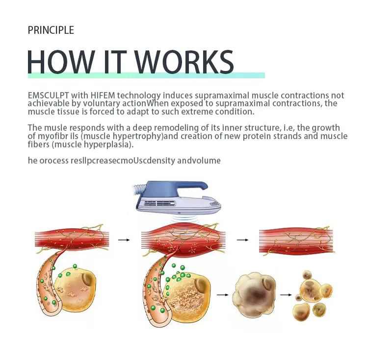 2024 Ems Body Slimming Machine slimming electronic muscle stimulate machine With 4 Handles