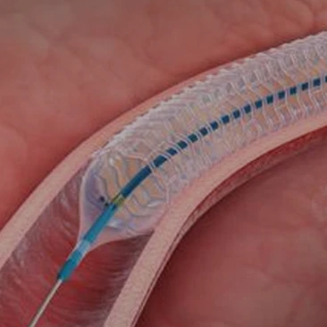 ISO сертифицированный медицинский интервенционный кардиологический воздушный насос PTCA воздушный катетер от производителя для кардиохирургии