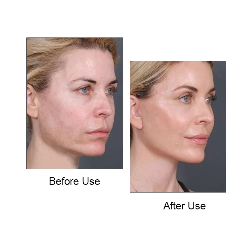 V Line Mask Band Slimming Strap Double Chin Reducer Face Lifting Bandage