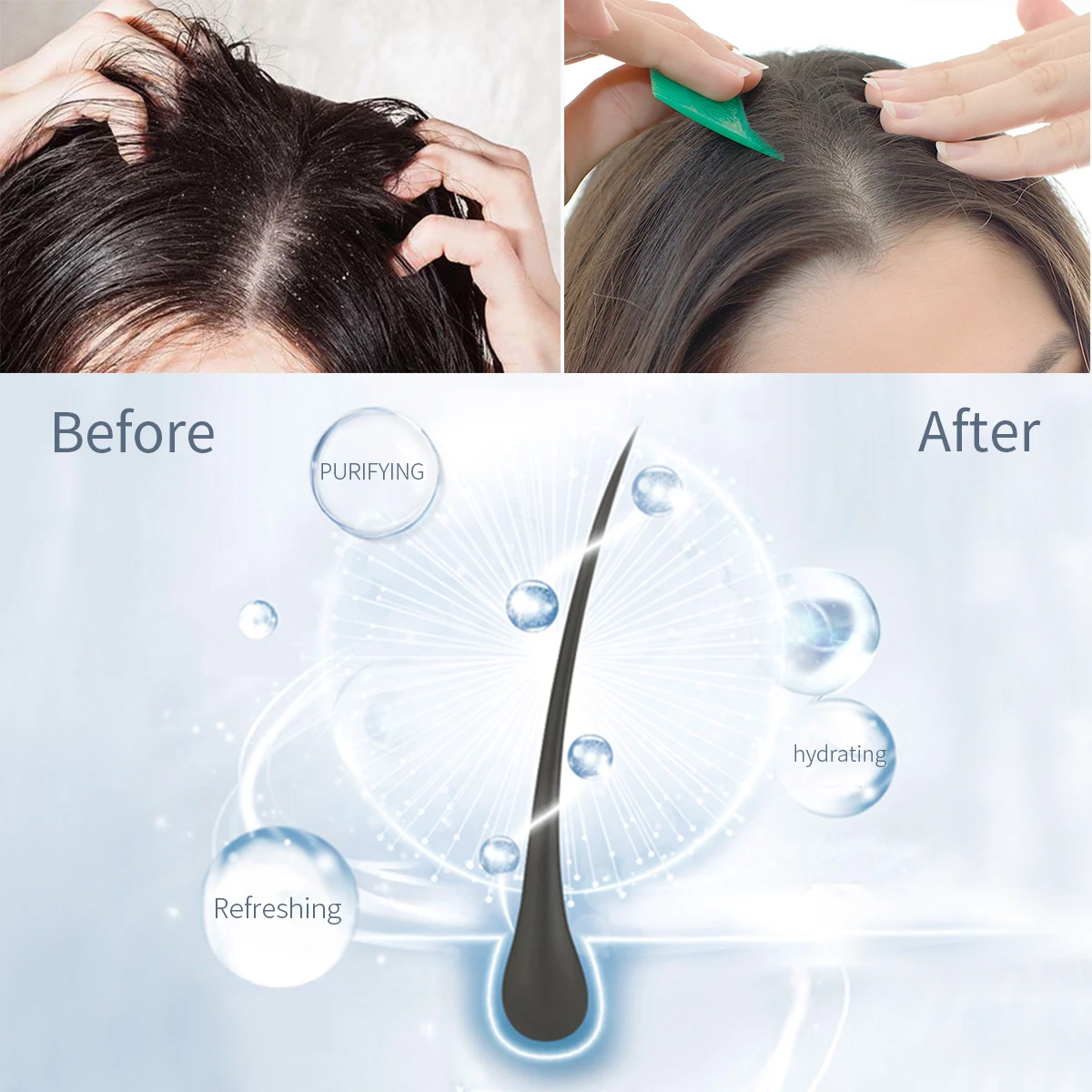 Professional Oil Control Moisturizing Anti-Itching Fucoidan Purifying Hair Care Organic Natural Dandruff Shampoo