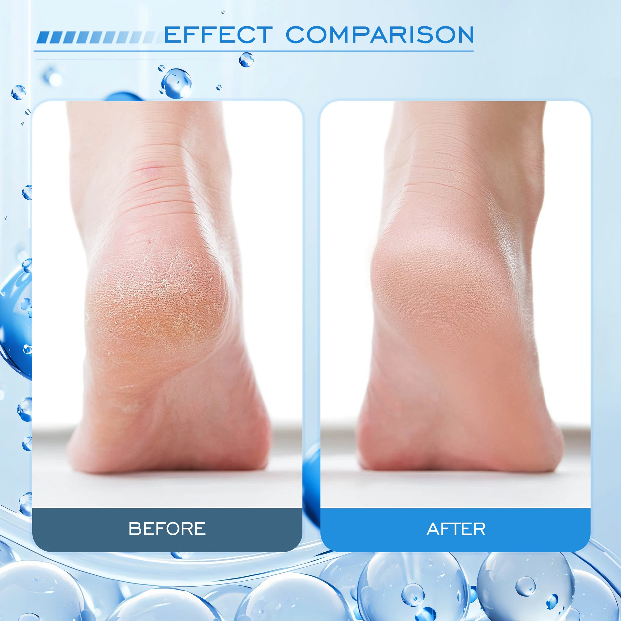 Custom Wholesale Soothing And Refreshing Repair Foot Care Deep Hydration Moisturizing Vitamin E Cocoa Butter Foot Cream