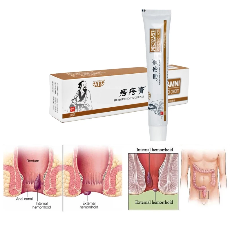 Hemorrhoids Ointment Internal External Anal Fissure Piles Pain Relief Cream Hemorrhoid Bleeding Swelling Relieve Balm 20g