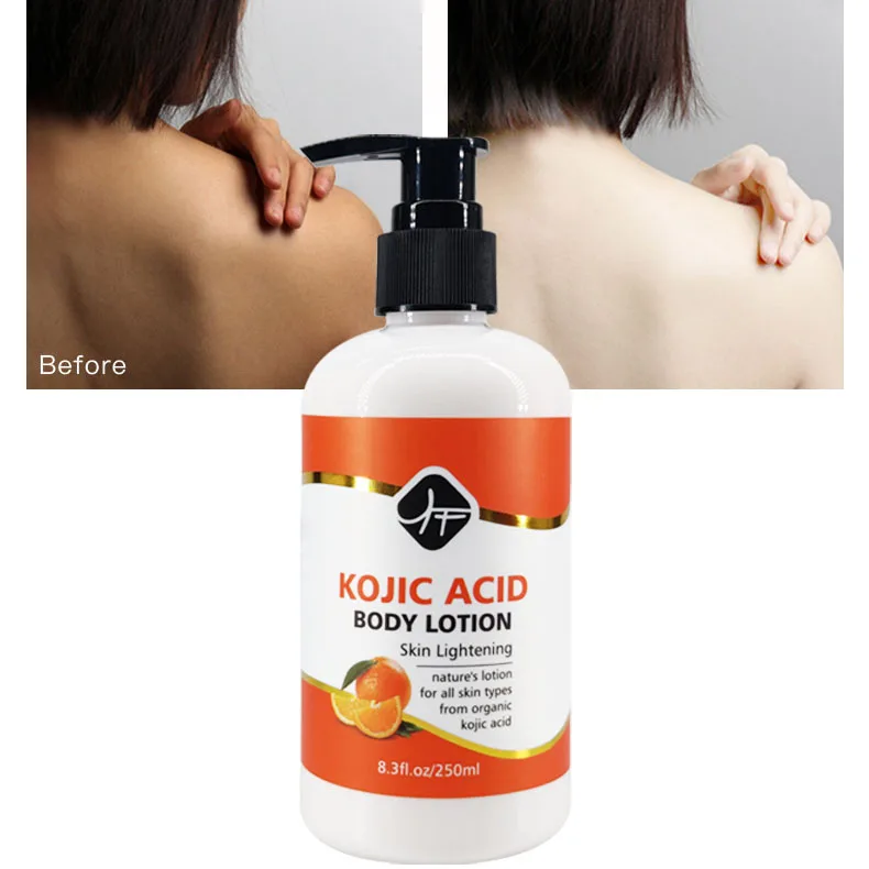 OEM Hot Sale body care Kojic acid whitening bleaching body lotion for black
