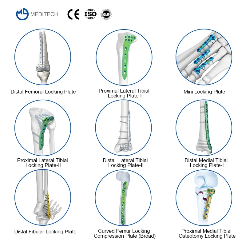 Medical Trauma Orthopedic Implants Titanium Proximal Humerus  Fractures Plate Proximal Humeral Locking Plate