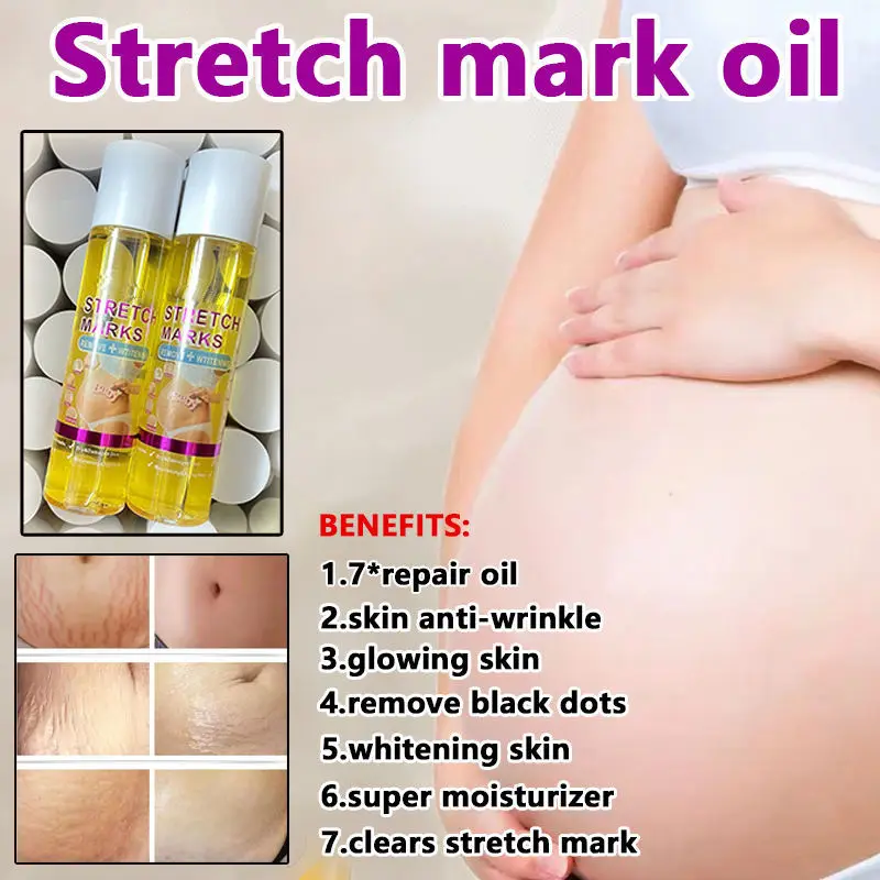 High Quality Wholesale 200 Ml Remove Stretch Mark Oil Bio Whitening Skincare Natural Essential Oil Lavender Massage Oil