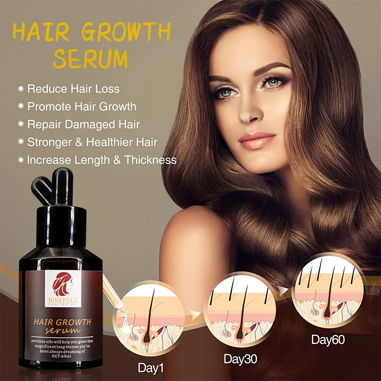 Private Label Natural Ginger Hair Growth Oil  Anti Loss Treatment Hair Oil Fast Hair Growth Serum