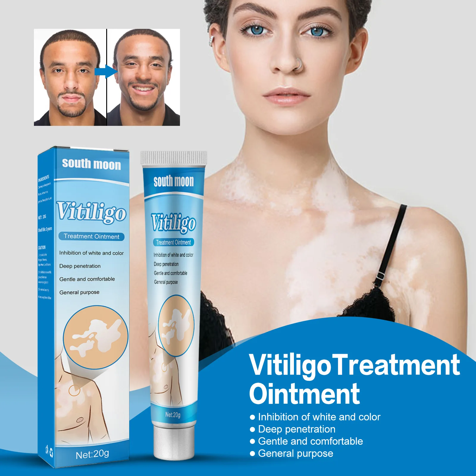 Body Care Fade Mottling Even Skin Tone And Lightened Body Spots Vitiligo Treatment Ointment