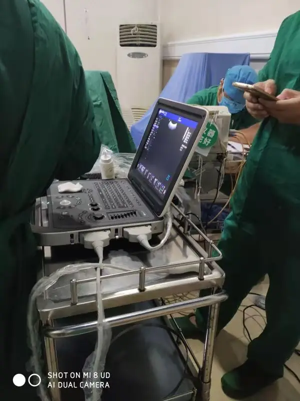 medical ultrasound instruments RUIHUA DU8-M1 model with two probe connectors Laptop Doppler Ultrasound  Echo Machine