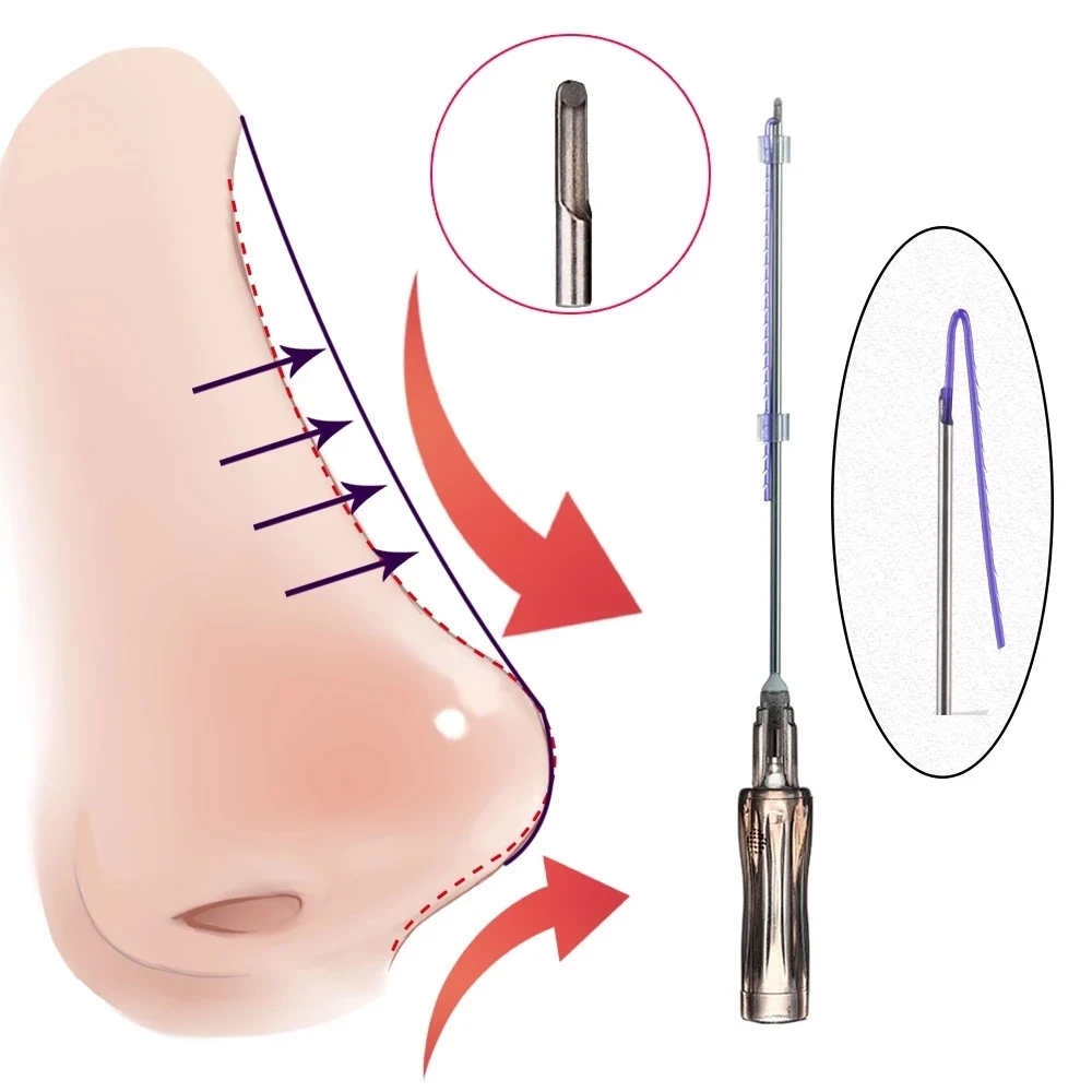 Korea Pdo 3D 4D Molding Cog Barbed Face Lifting Thread