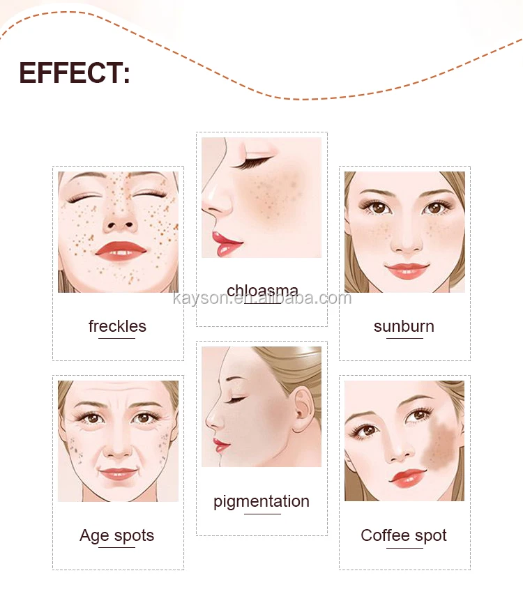 Herbal Face Anti Dark Spot Orient Golden Pearl Royal Expert Whitening Cream Pakistan