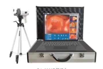 Portable digital colposcope