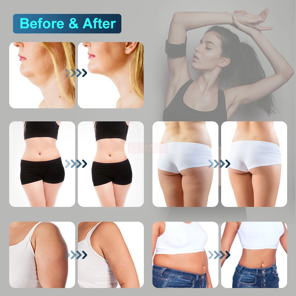 3 in 1 40K Reduce Fat Multipolar RF Body Slimming Cavitation Machine Product For Weight Loss