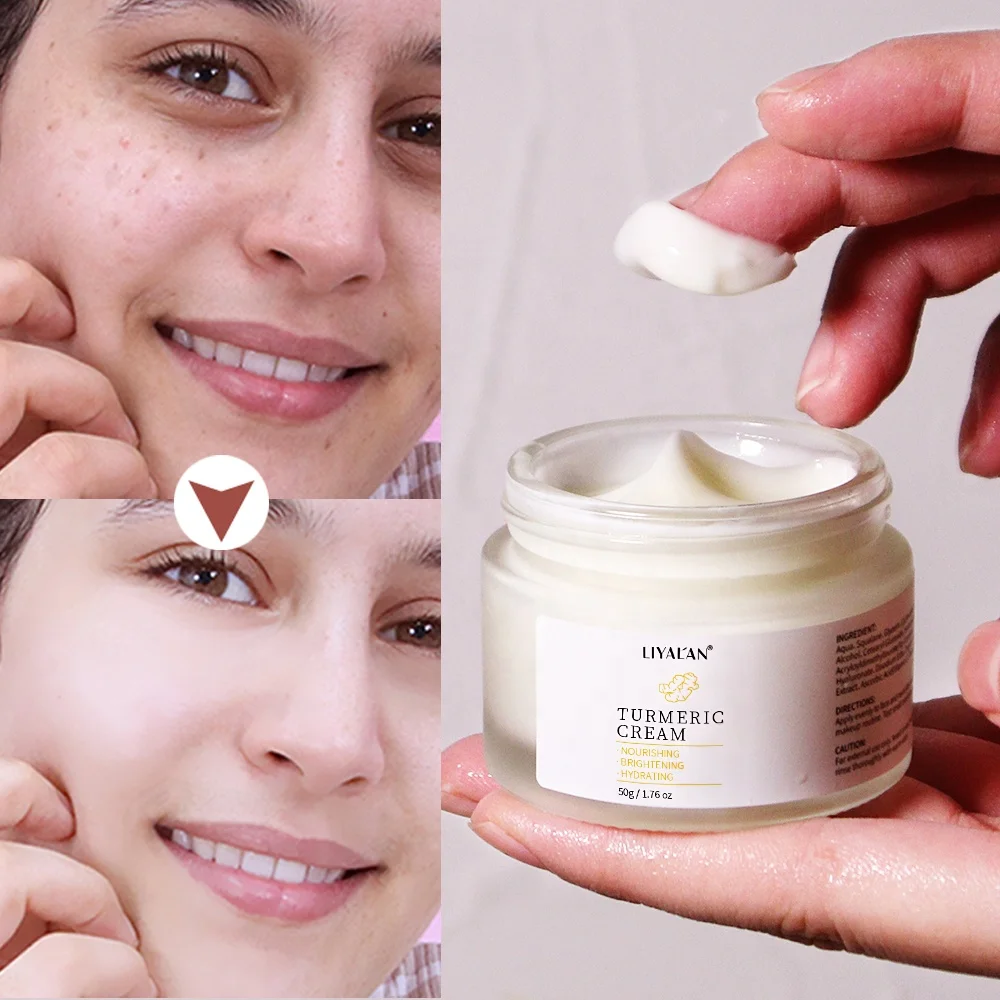 Natural Tumeric Vitamin C Acne Dark Spot Remover Facial Cream & Lotion Skin Whitening Turmeric Face Cream