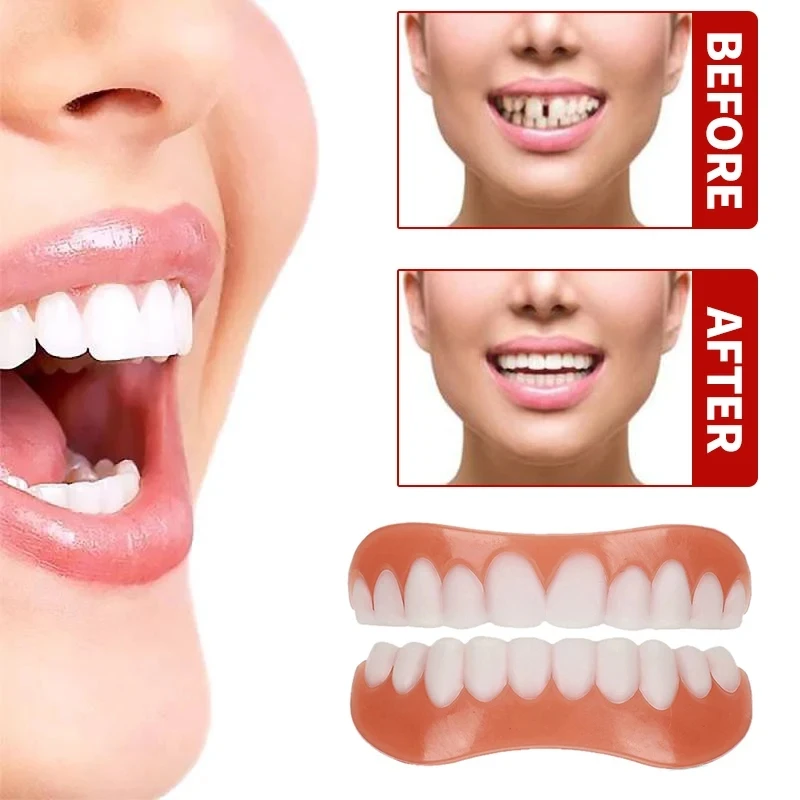 Comfortable Silicone Emulational Veneers False Teeth Cosmetic Denture