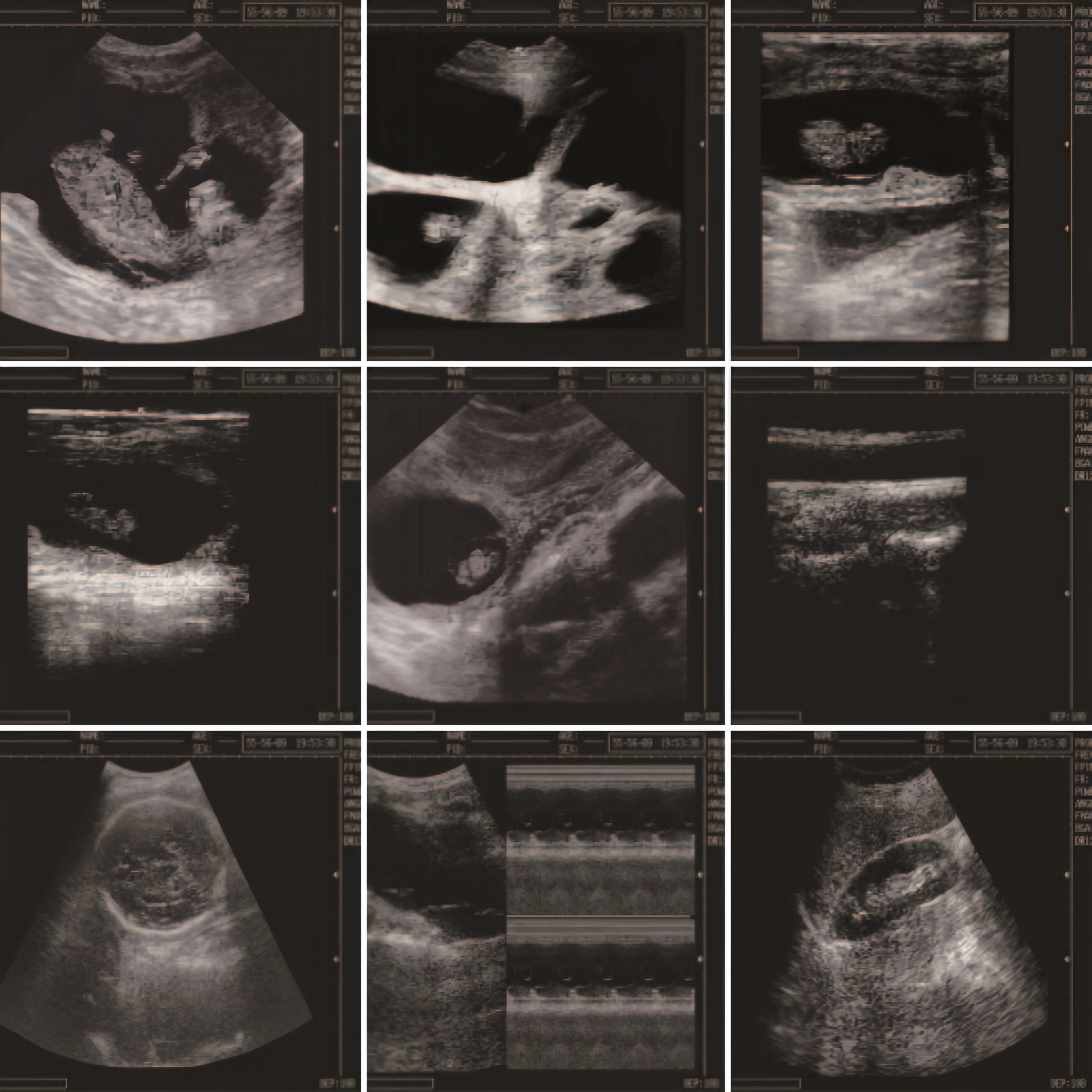 WELLD Medical Machine Portable Veterinary Human Doppler Multi-Frequency Probes Full Digital Ultrasonic Diagnostic System Scanner