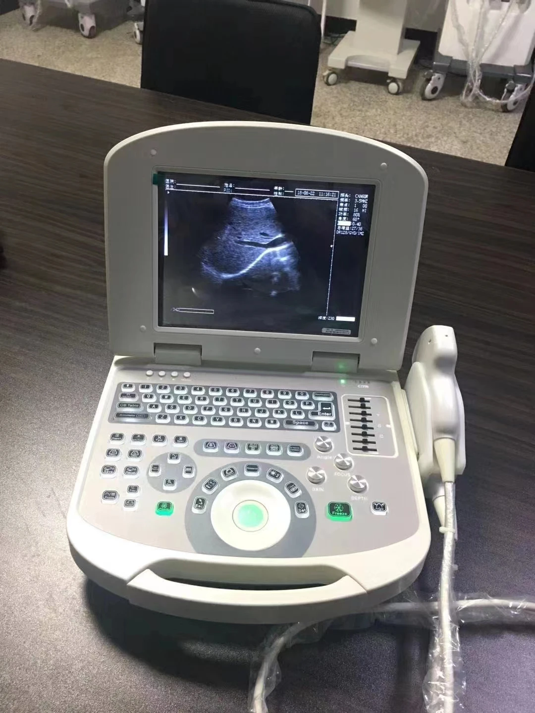Full Digital Ultrasound Machine portable Ultrasound Machine veterinary Equipment
