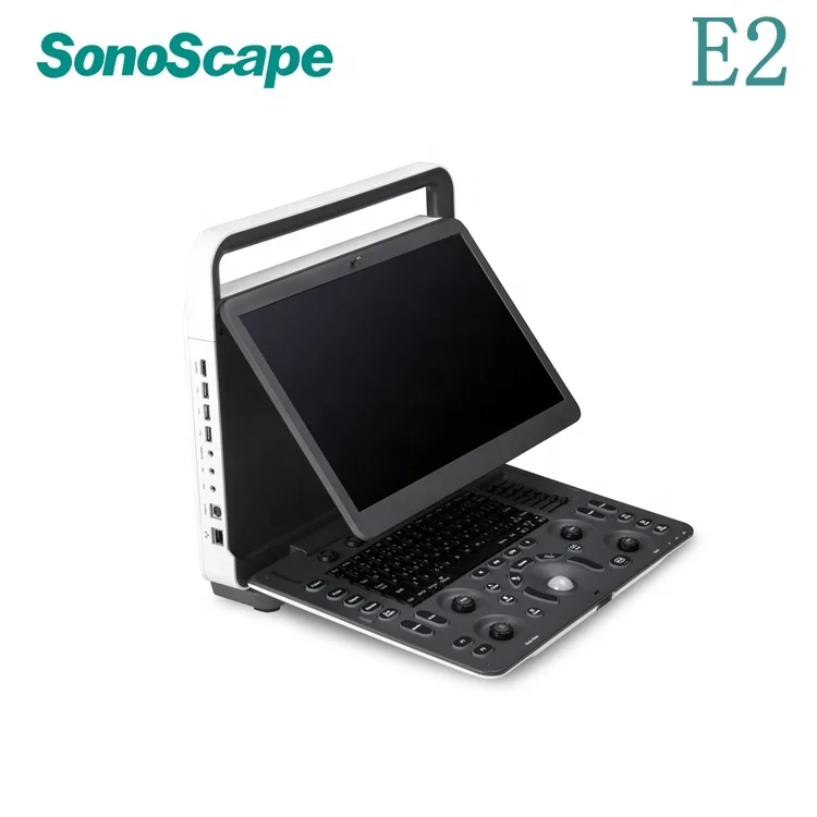 Sonoscape E1EXP E2 ультразвуковой цветной допплер