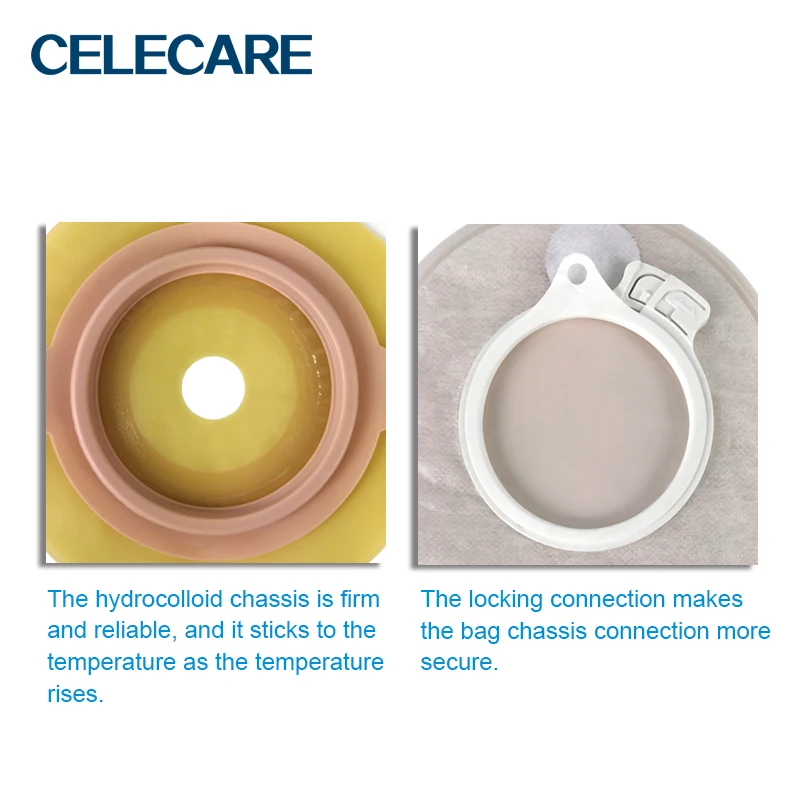 CELECARE 2 Piece Colostomy Bags Chassis Hypoallergenic Ostomy Products B035