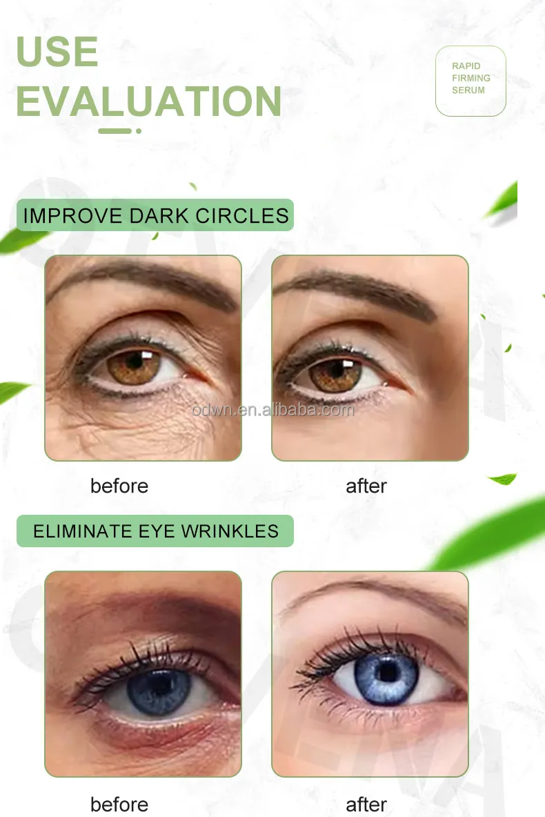 Rebrand OTVENA Anti-Wrinkle Eye Cream Rapid Skin Care Lifting Serum