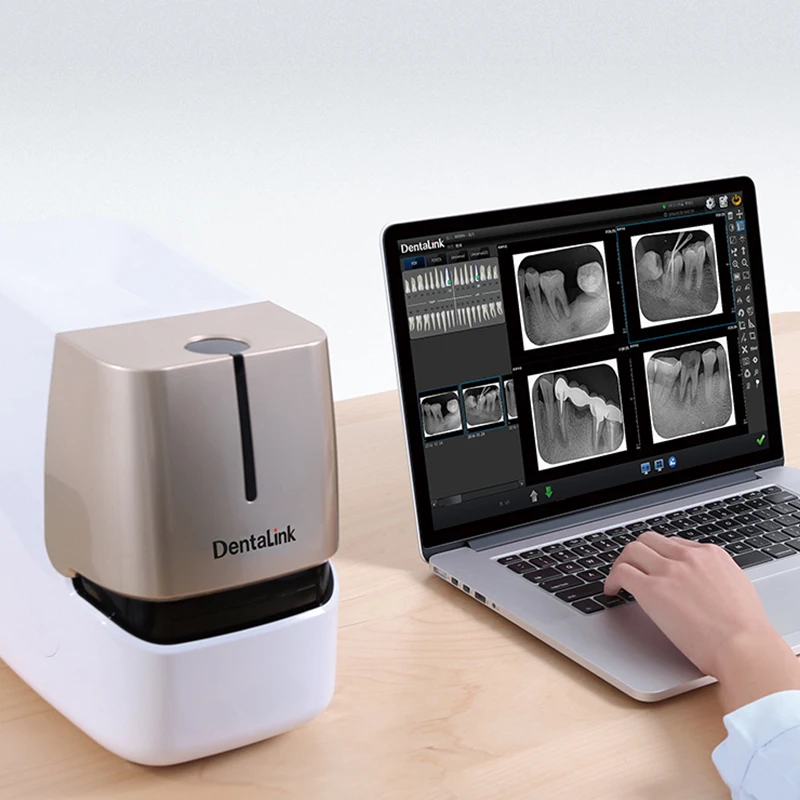 Digital Dental Imaging phosphor plate Scanner