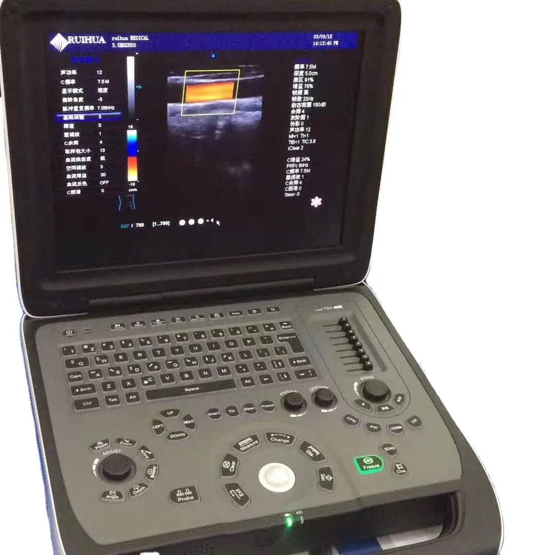 RuiHua brand factory Price  echo Color Doppler portable Ultrasound scan two probe connectors laptop cardiac ultrasound