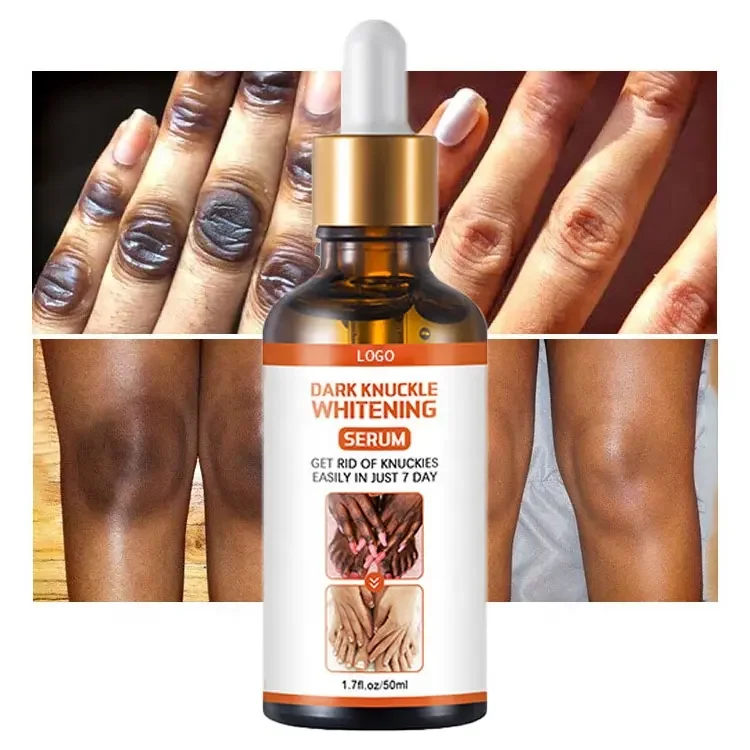 Custom Black skin Remover Dark Elbows Hand Legs Knees Strong Effective Dark Knuckle Whitening Serum