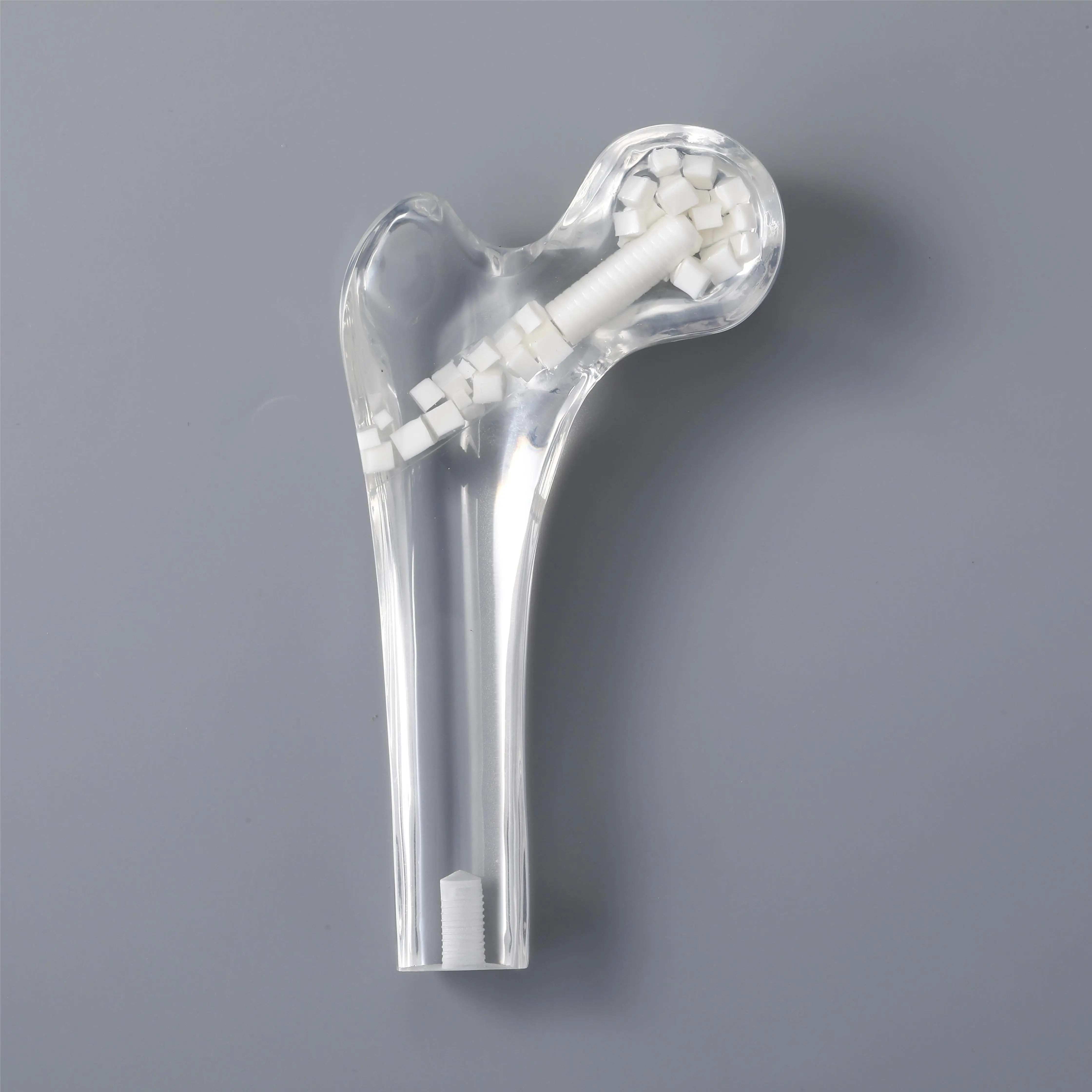 Ортопедический хирургический имплантат, биомиметический минерализованный коллаген, синтетические гранулы для наполнения костей, костные трансплантаты, наполнитель пустот