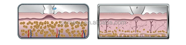 Rotary RF Slim 1 (2).jpg