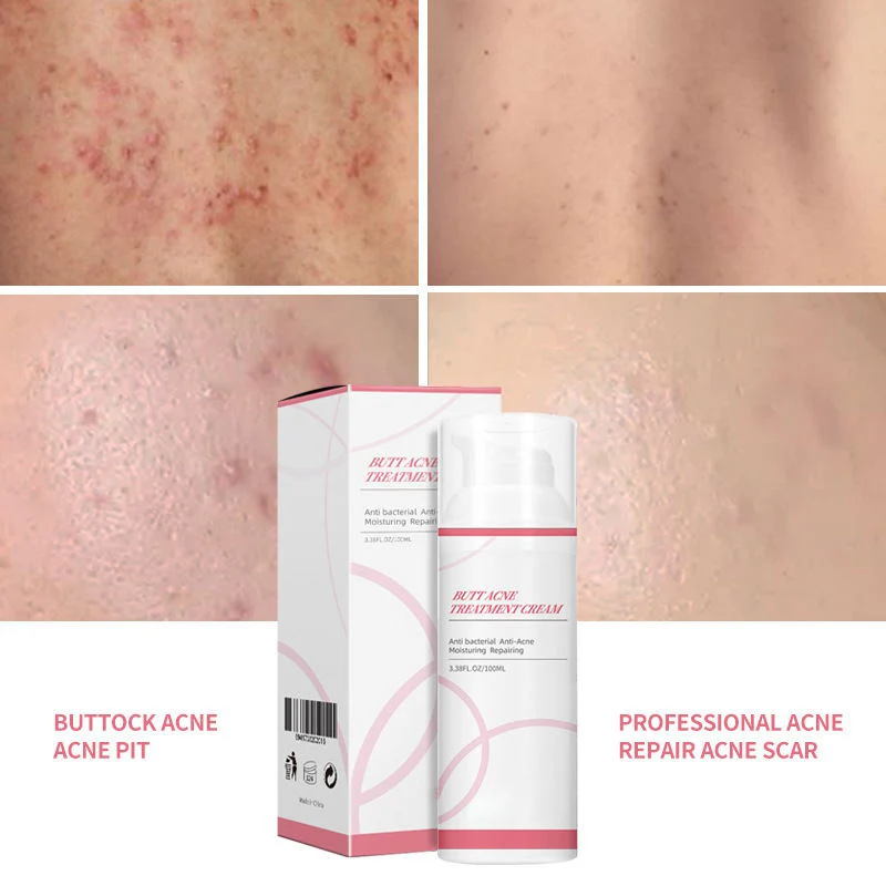 Natural Organic Hip Massage Butt Enlargement Private Label Shea Butter Butt Enhancement Cream