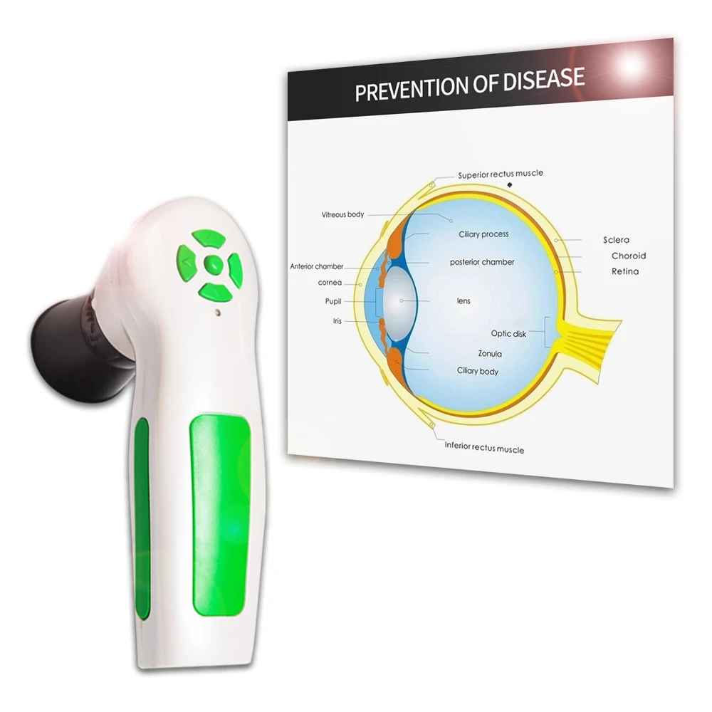 12 М пикселей глаз iriscope iridology камера цифровой здоровья анализатор