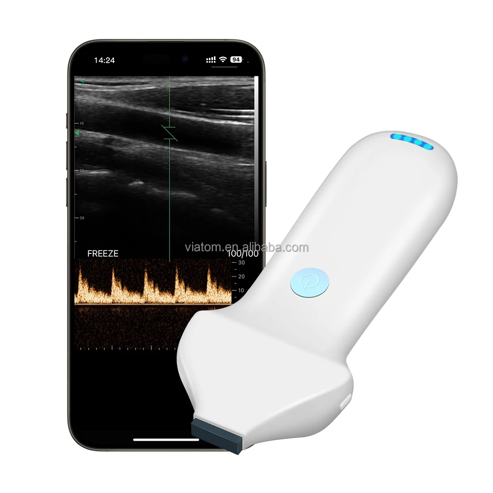 Viatom 192 Elements Handheld Ultrasound Beauty Injections High Frequency Linear Portable 18/24Mhz Wireless Ultrasound Probes