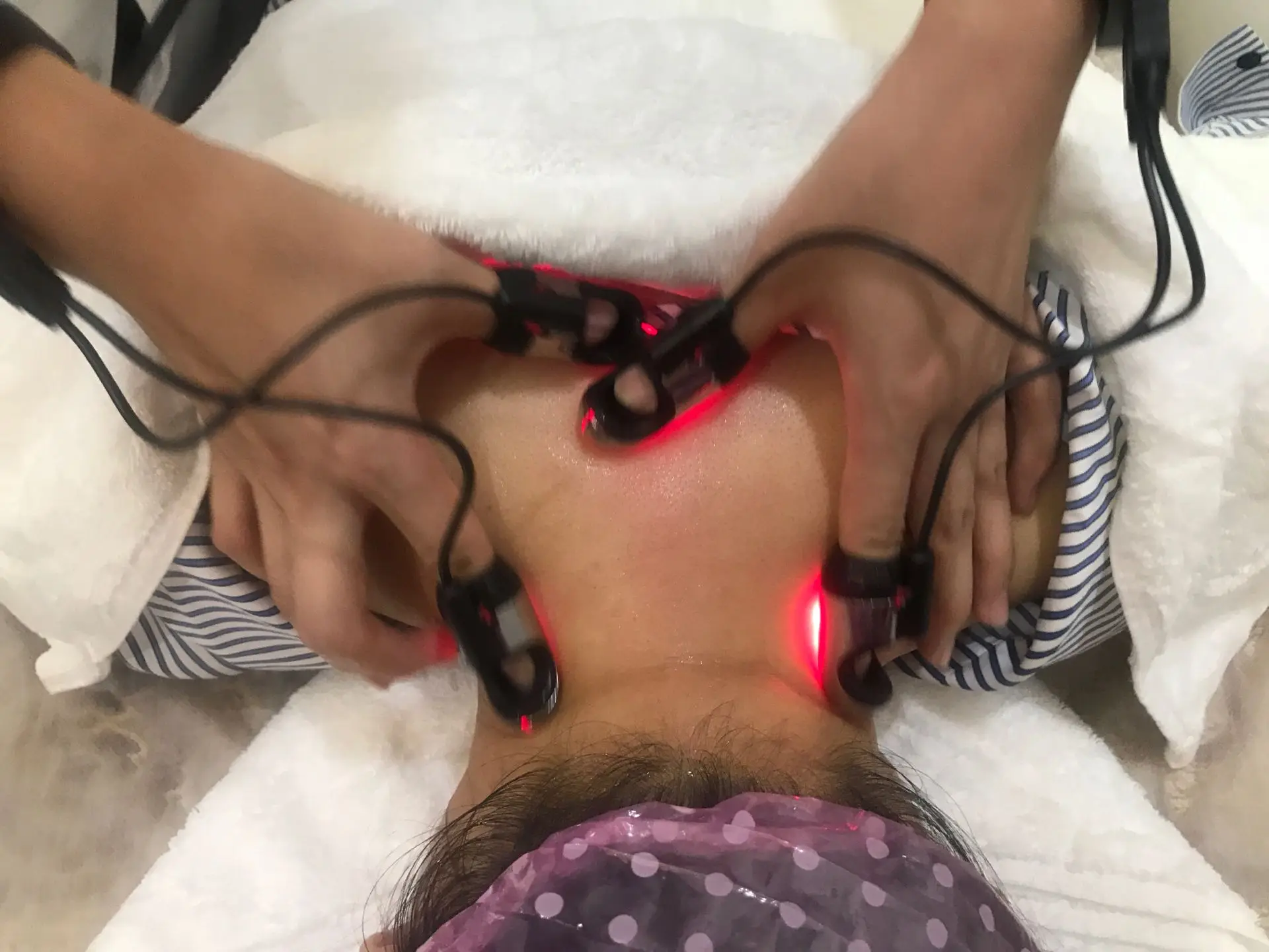 China manufacture platinum finger facial skin care beauty equipment S31