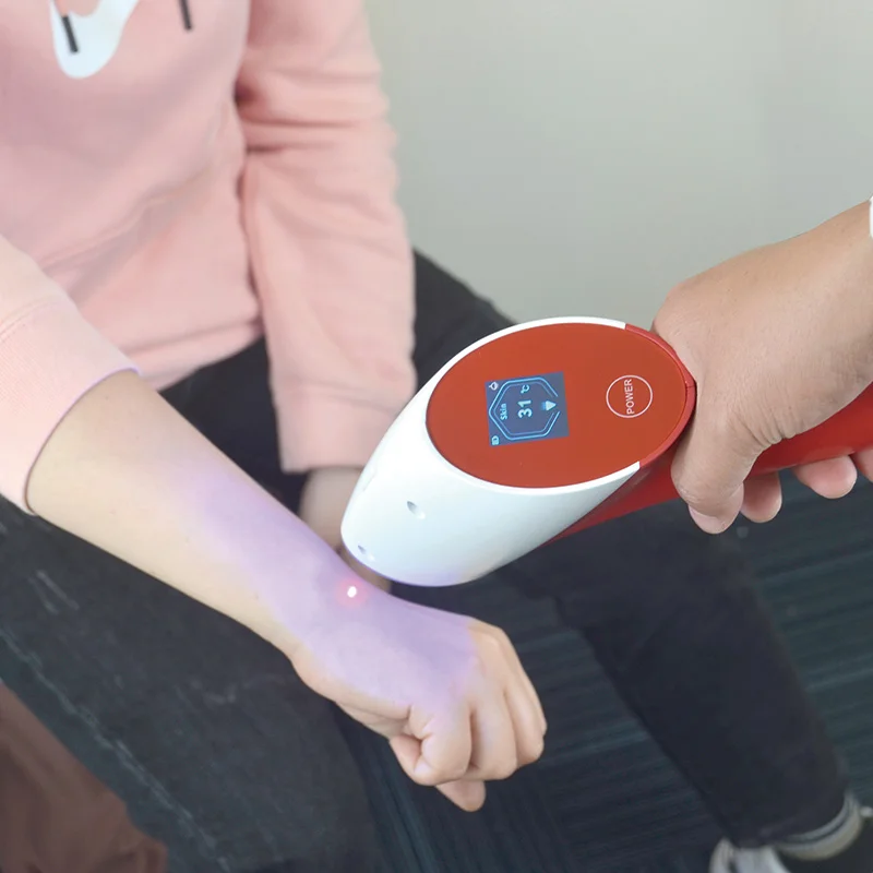Effective Local Cryotherapy Machine for Injury Recovery and Pain Relief Co2 Device