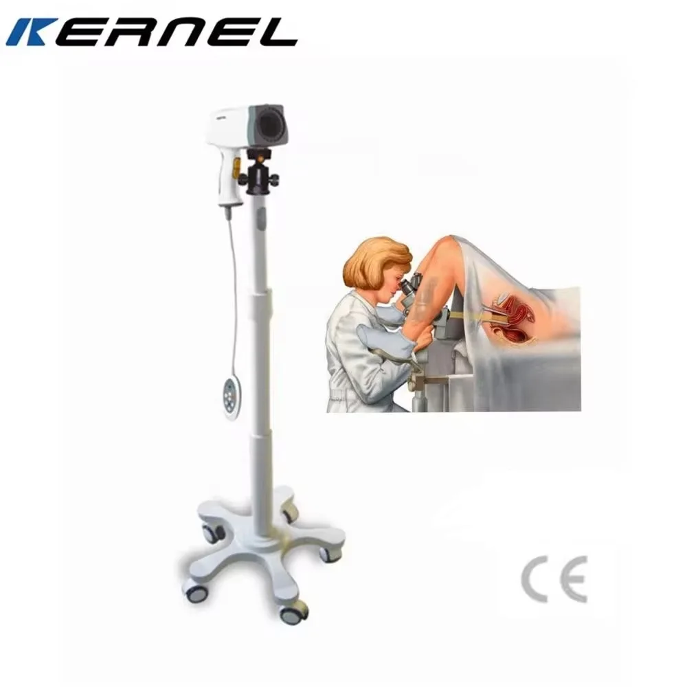2024 Medical Digital Gynecologic Examination Colposcope HD Video Vaginal Camera for Gynecology Vagina Endoscope