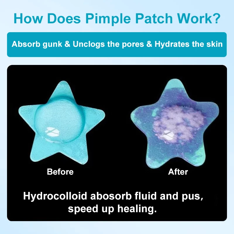 pimple patch detail (12).jpg