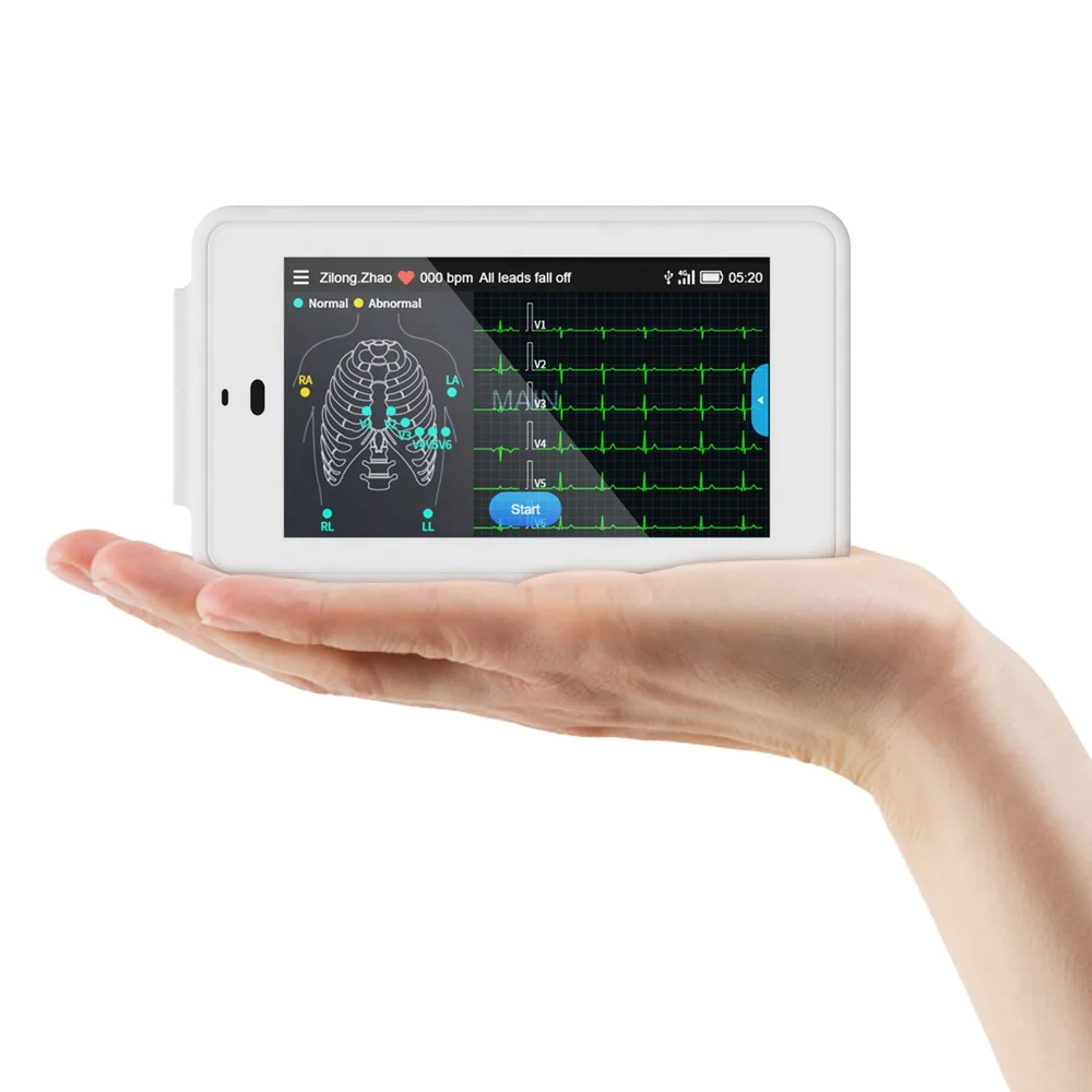 Wellue PCECG 500 24 Hours 12 Channel  ECG Device Electrocardiograma Wearables ECG