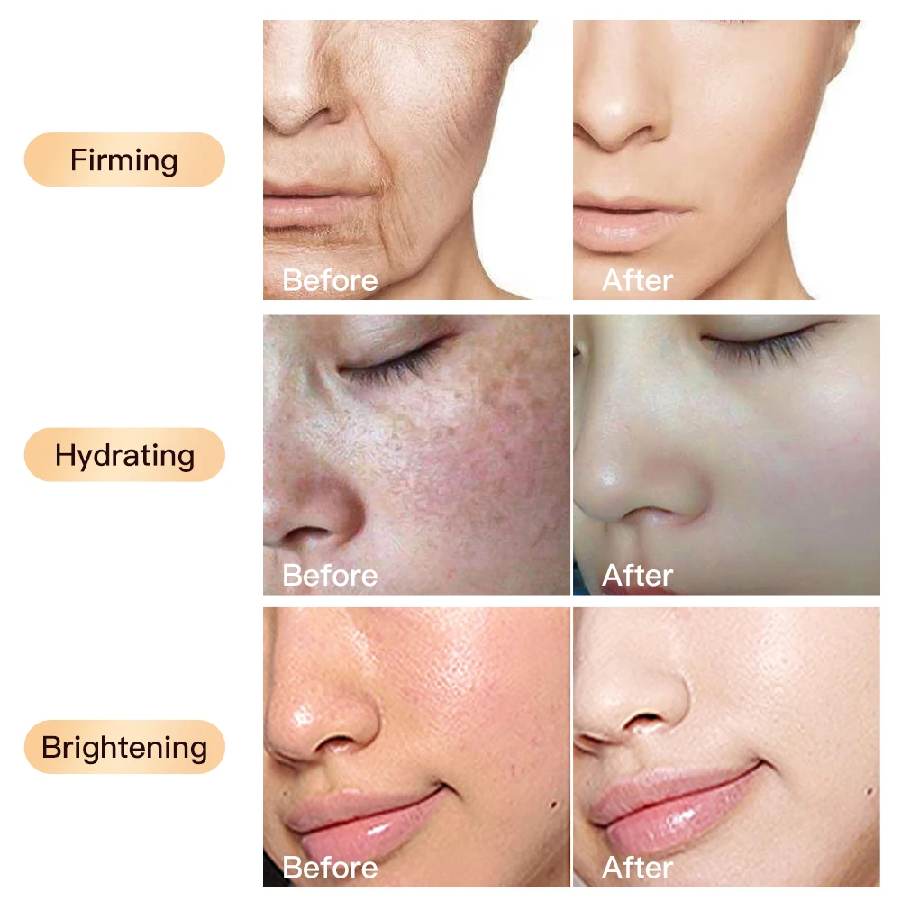 Органический корейский уход за кожей антивозрастной коллагеновый мазок для лица рисовый Тонер сыворотка ниацинамида с витамином С крем набор ухода