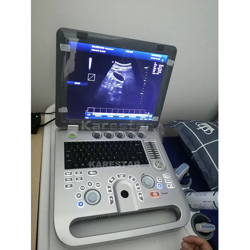 KARESTAR 3D 4D Full Digital Laptop Ultrasound of Dog Abdomen Pancreas Ultrasound