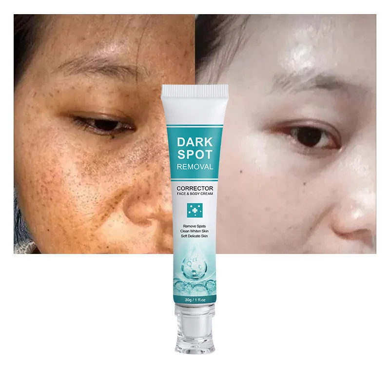 Wholesale Dark Spot Remover Facial Cream Pimples Acne Mark Dark Spots corrector Whitening Face Cream For Skincare Products