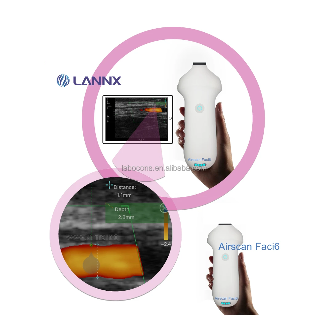 LANNX Airscan Faci6 In stock Color USG Scanner 3 in 1 ultrasound Probe for Mapping Injection Wireless Portable Probe Ultrasound