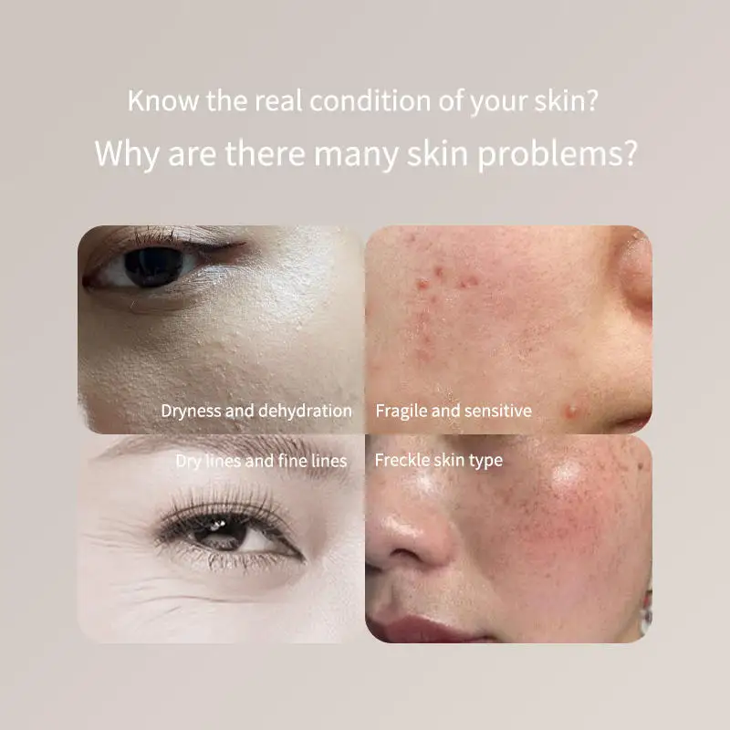 Rechargeable electronic facial oil tester hydration detector machine LCD display skin analyzer water oil tester analysis device