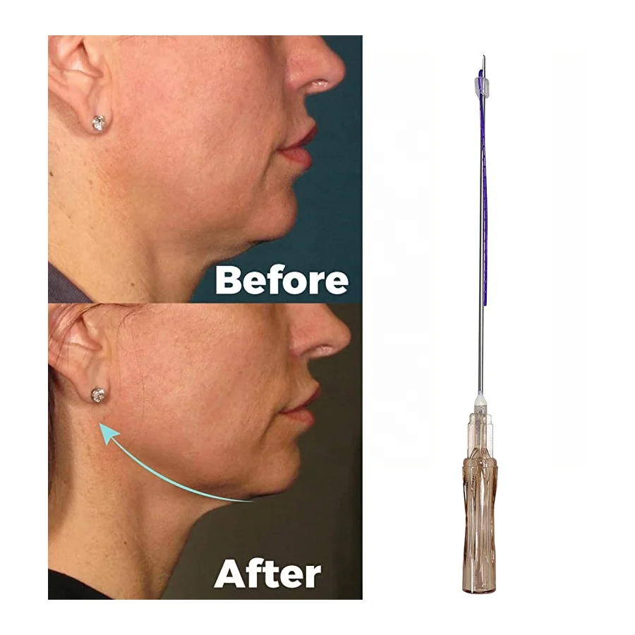 Premium Mono Collagen Thread Face Lifting Korean Hilos Tensores Para Cara Y Cuello